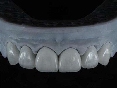 Як замовити роботу техніка зуботехнічної лабораторії за кордоном: вичерпний п...